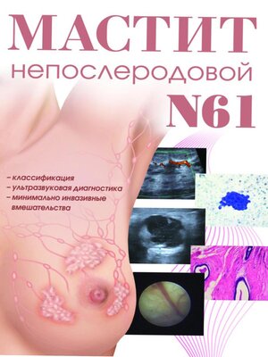 cover image of Мастит непослеродовой N61